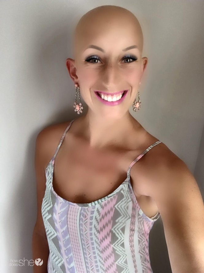 Young woman with bald head smiling
