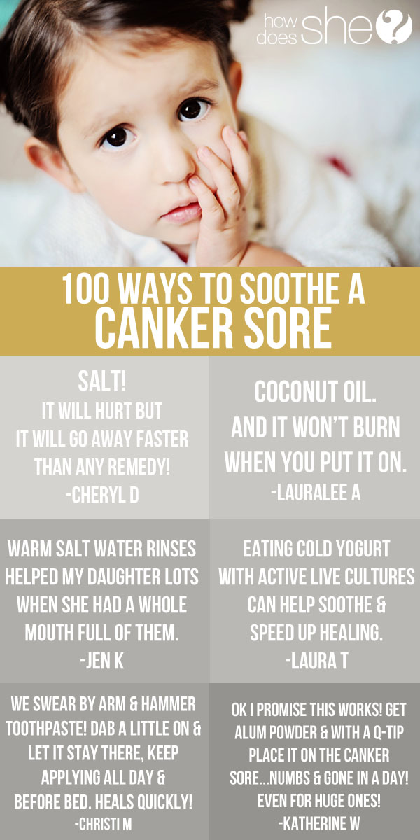 Brilliant Ways To Soothe A Canker Sore